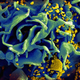 Image for article titled Researchers Have Identified The Origin Of The AIDS Pandemic